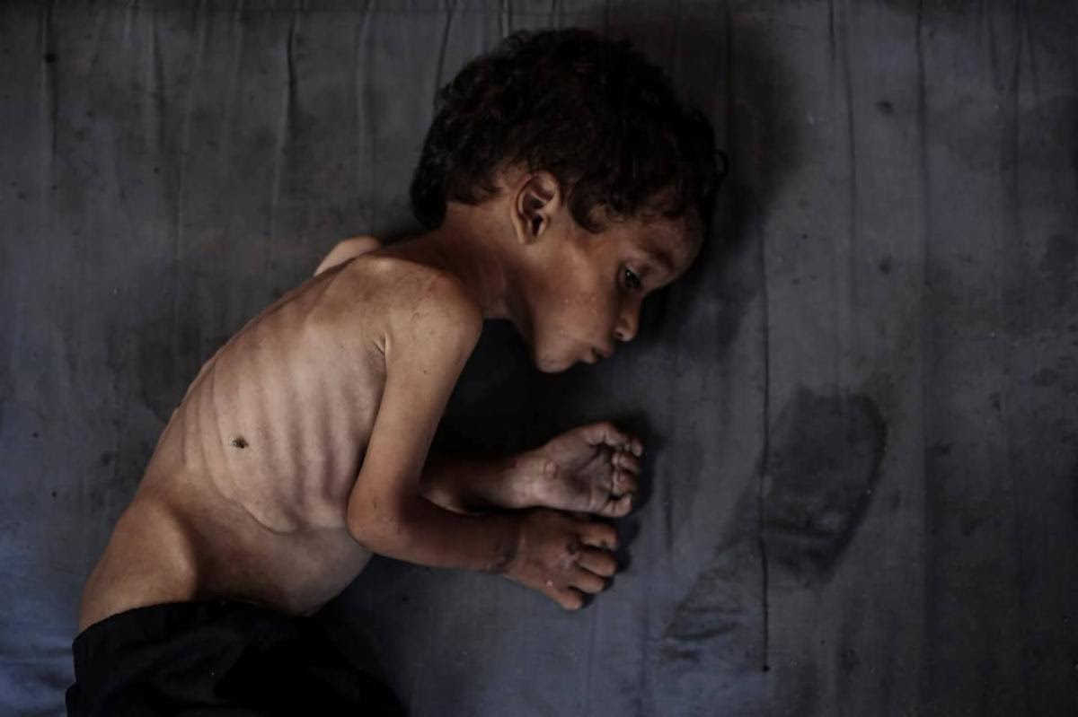 Israel’s Famine in Gaza: What the World Must Know